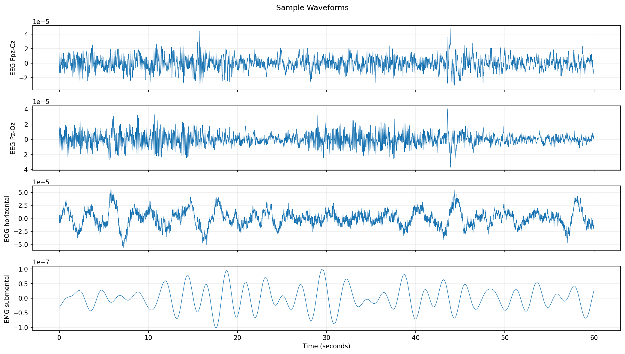 Sample EEG and EOG waveform visualization for the sleep stage classification project